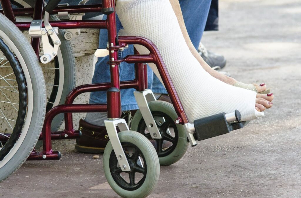 Person in a wheelchair after an accident. Needing casts on both legs for the ankle. 